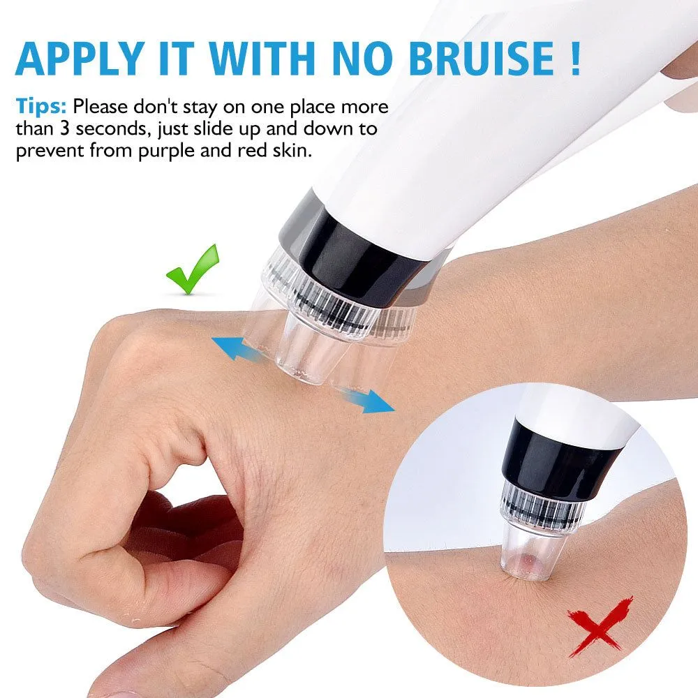 Blackhead Vacuum Suction - Pore Vacuum Cleaner Facial Blackhead Acne Removal Tools